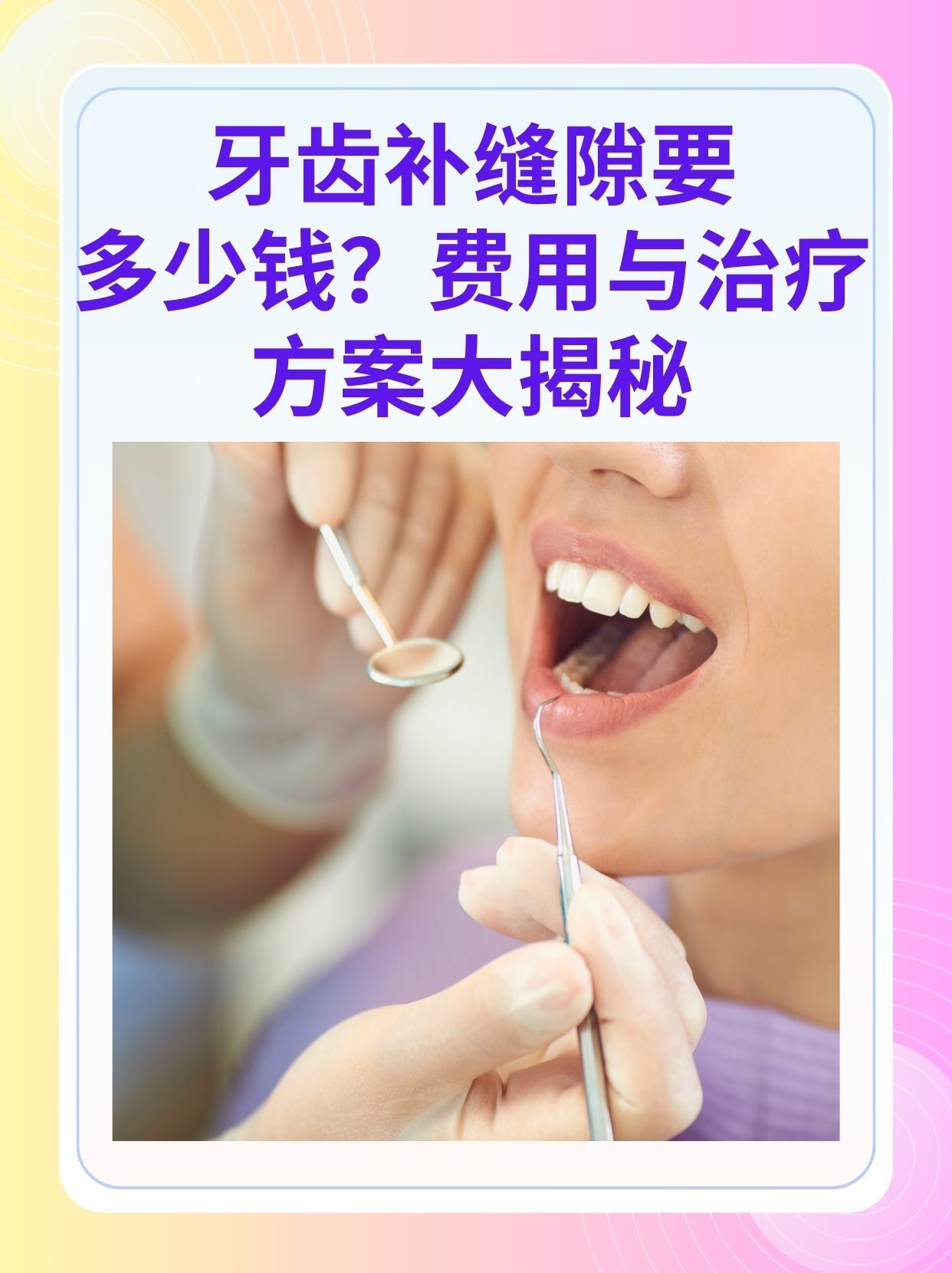 遂宁补牙医保可以报销吗(补牙医保可以报销吗 哪些可以报销呢)